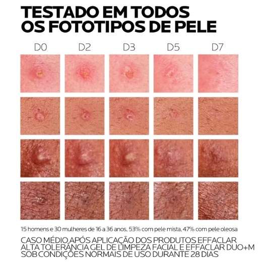 Effaclar DuoeM Creme Antiacne La Roche Posay 40ml